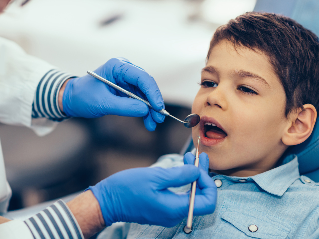 Bệnh sâu răng rất phổ biến ở trẻ em
